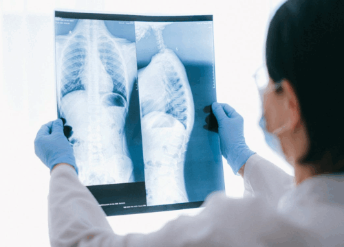 Breathing with Ease: Enjoying Healthy Lungs for Life